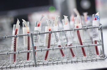 Transfusion medicine samples